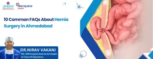 FAQs About Hernia Surgery in Ahmedabad