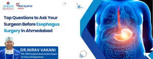 Esophagus Surgery Questions in Ahmedabad