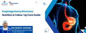 Esophagectomy Recovery Nutrition & Follow-Up Care Guide