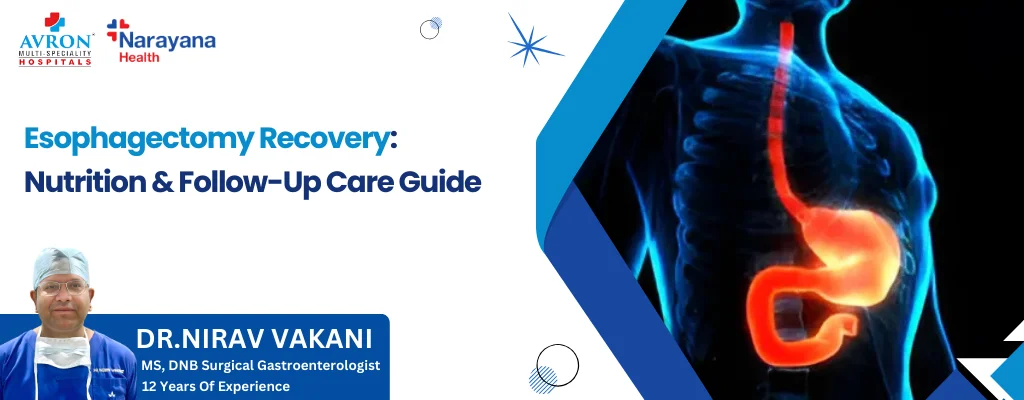 Esophagectomy Recovery Nutrition & Follow-Up Care Guide