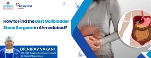 Find the Best Gallbladder Stone Surgeon in Ahmedabad