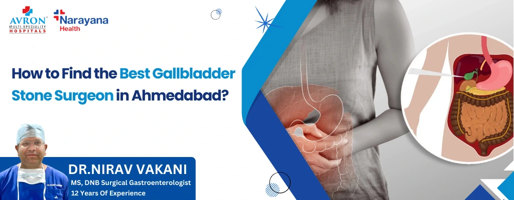 Find the Best Gallbladder Stone Surgeon in Ahmedabad