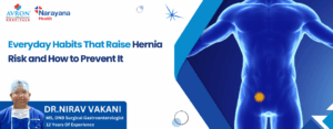Hernia Risk and How to Prevent
