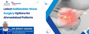 Gallbladder Stone Surgery Options Ahmedabad