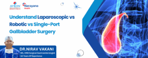 Laparoscopic vs Robotic vs Single-Port Gallbladder Surgery
