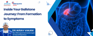 Gallstone Journey