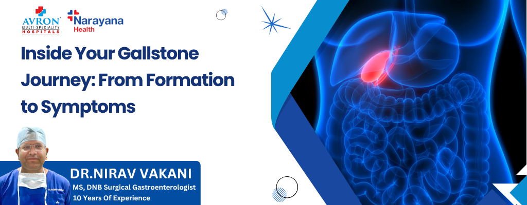 Gallstone Journey