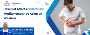 How Diet Affects Gallstones