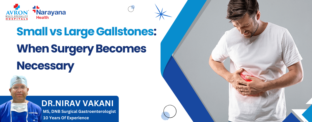 Small vs Large Gallstones